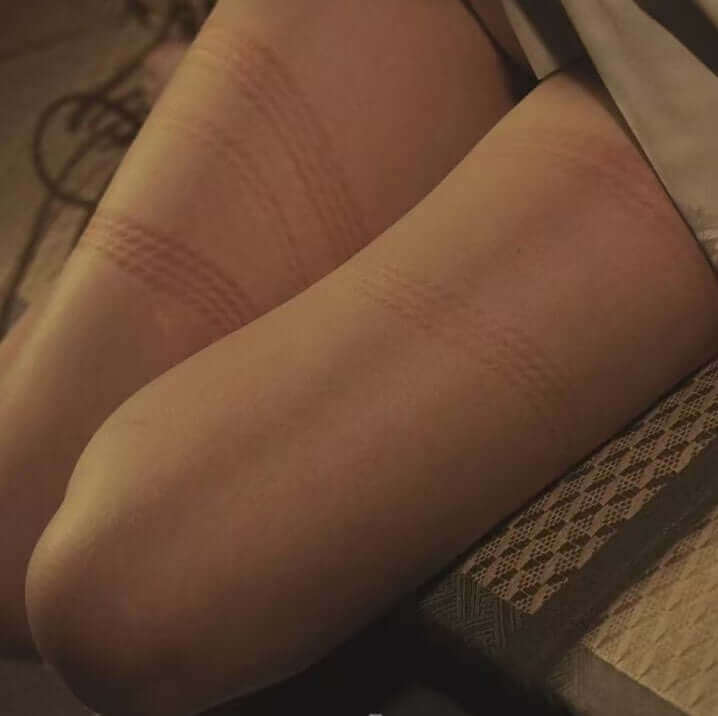 close-up of a leg displaying Shibari technique marks, illustrating understanding Shibari techniques and its impact